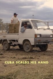 Cuba Scalds His Hand